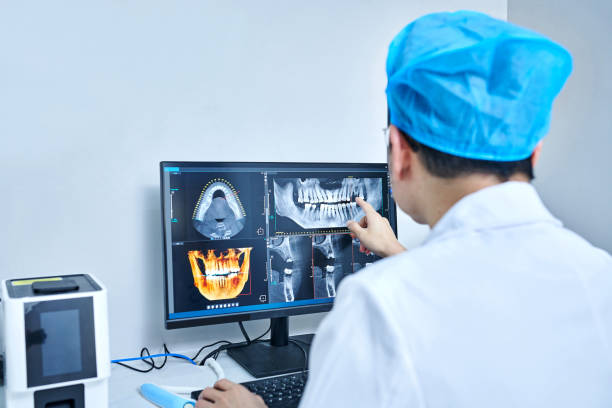 Best Chipped Tooth Repair Near Me  in Purdy, WA